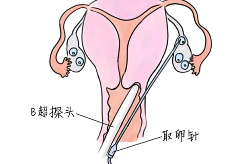 http://suzhou.vdtfzz.com/post/205.html|苏州供卵助孕