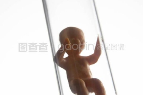 http://suzhou.vdtfzz.com/post/197.html|苏州试管助孕
